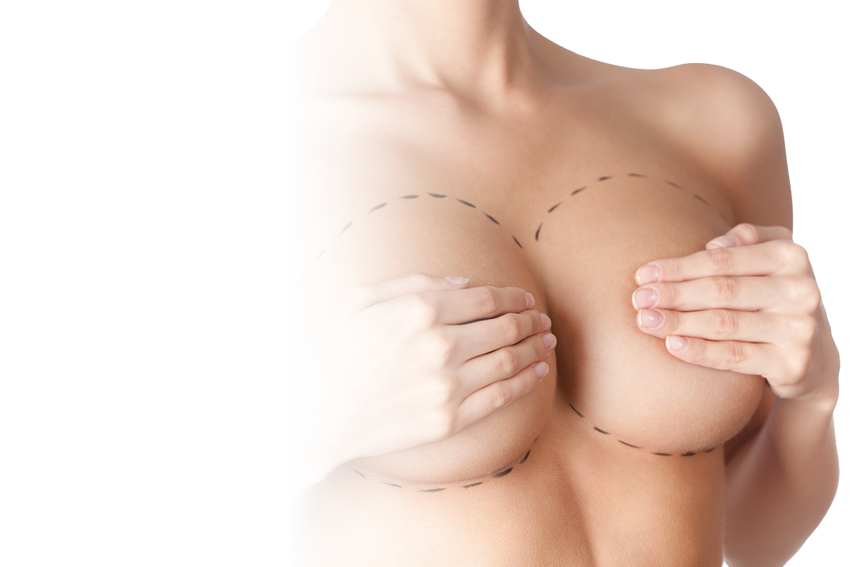 Prótese de Mama